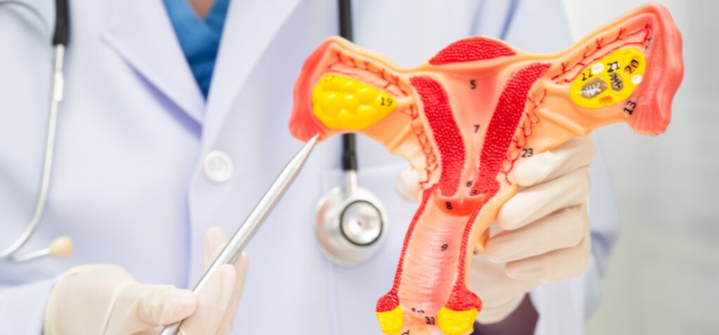 Arcuate Uterus What It Means for Fertility, Pregnancy, and Trying to Conceive
